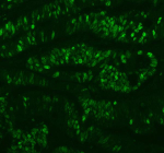Immunofluorescent staining of Ki67/MKI67 using anti-Ki-67 antibody (green). Ki67/MKI67 was detected in a paraffin-embedded section of human intestine cancer tissue. Heat mediated antigen retrieval was performed in EDTA buffer (pH 8.0, epitope retrieval solution). The tissue section was blocked with 10% goat serum. The tissue section was then incubated at 1:50 rabbit anti-Ki-67 antibody overnight at 4oC. DyLight 488 Conjugated Goat Anti-Rabbit IgG was used as secondary antibody at 1:500 dilution and incubated for 30 minutes at 37oC. Visualize using a fluorescence microscope and filter sets appropriate for the label used.