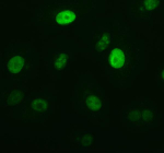 Immunofluorescent staining of Ki67/MKI67 using anti-Ki-67 antibody (green). Ki67/MKI67 was detected in an immunocytochemical section of cells. Enzyme antigen retrieval was performed using IHC enzyme antigen retrieval reagent for 15 mins. The cells were blocked with 10% goat serum. And then incubated at 1:50 rabbit anti-Ki-67 antibody overnight at 4oC. DyLight488 Conjugated Goat Anti-Rabbit IgG was used as secondary antibody at 1:500 dilution and incubated for 30 minutes at 37oC. Visualize using a fluorescence microscope and filter sets appropriate for the label used.