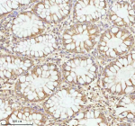 Immunohistochemical staining of PLBD2 using anti-PLBD2 antibody. PLBD2 was detected in a paraffin-embedded section of human rectum tissue. Heat mediated antigen retrieval was performed in EDTA buffer (pH 8.0, epitope retrieval solution). The tissue section was blocked with 10% goat serum. The tissue section was then incubated with 2 ug/ml rabbit anti-PLBD2 antibody overnight at 4oC. Peroxidase Conjugated Goat Anti-rabbit IgG was used as secondary antibody and incubated for 30 minutes at 37oC. The tissue section was developed using an HRP secondary and DAB substrate.