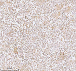 Immunohistochemical staining of PLBD2 using anti-PLBD2 antibody. PLBD2 was detected in a paraffin-embedded section of human testicular seminoma tissue. Heat mediated antigen retrieval was performed in EDTA buffer (pH 8.0, epitope retrieval solution). The tissue section was blocked with 10% goat serum. The tissue section was then incubated with 2 ug/ml rabbit anti-PLBD2 antibody overnight at 4oC. Peroxidase Conjugated Goat Anti-rabbit IgG was used as secondary antibody and incubated for 30 minutes at 37oC. The tissue section was developed using an HRP secondary and DAB substrate.
