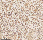 Immunohistochemical staining of PLBD2 using anti-PLBD2 antibody. PLBD2 was detected in a paraffin-embedded section of human testicular seminoma tissue. Heat mediated antigen retrieval was performed in EDTA buffer (pH 8.0, epitope retrieval solution). The tissue section was blocked with 10% goat serum. The tissue section was then incubated with 2 ug/ml rabbit anti-PLBD2 antibody overnight at 4oC. Peroxidase Conjugated Goat Anti-rabbit IgG was used as secondary antibody and incubated for 30 minutes at 37oC. The tissue section was developed using an HRP secondary and DAB substrate.