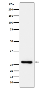 Western blot analysis of TRAIL R3 expression in human Jurkat cell lysate using TRAIL R3 antibody. Predicted molecular weight ~27 kDa.