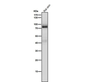 Western blot testing of rat skin tissue lysate using the Pan-PKC antibody at 1:5000 dilution for 1 hour at room temperature.