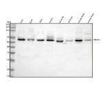 Western blot analysis of RNF25 using anti-RNF25 antibody. Lane 1: human Hela whole cell lysates, Lane 2: human U251 whole cell lysates, Lane 3: human 293T whole cell lysates, Lane 4: human Jurkat whole cell lysates, Lane 5: rat testis tissue lysates, Lane 6: rat brain tissue lysates, Lane 7: mouse testis tissue lysates, Lane 8: mouse brain tissue lysates. After electrophoresis, proteins were transferred to a nitrocellulose membrane at 150 mA for 50-90 minutes. Blocked the membrane with 5% non-fat milk/TBS for 1.5 hour at RT. The membrane was incubated with rabbit anti-RNF25 antibody at 0.5 ug/ml overnight at 4oC, then washed with TBS-0.1%Tween 3 times with 5 minutes each and probed with a goat anti-rabbit IgG-HRP secondary antibody at a dilution of 1:5000 for 1.5 hour at RT. The signal was developed using enhanced chemiluminescent. Although the predicted MW is ~51 kDa, RNF25 migrates at ~60-65 kDa, consistent with post-translational modification (e.g., phosphorylation/SUMOylation) and known anomalous mobility of RING E3 ligases.