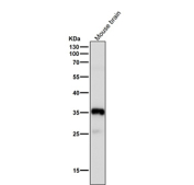 Western blot testing of mouse brain tissue lysate using the Phospho-Nucleophosmin (Ser125) antibody at 1:3000 dilution for 1 hour at room temperature. A predominant band is observed at ~35 kDa, consistent with phosphorylated NPM1 migrating slightly above its predicted 33 kDa. An additional ~26 kDa species is detected, consistent with a Ser125-containing proteolytic fragment of NPM1 that appears in some cell lysates.