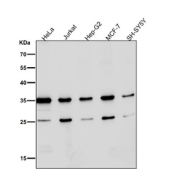 Western blot testing of human samples using the Phospho-Nucleophosmin (Ser125) antibody at 1:3000 dilution for 1 hour at room temperature. A predominant band is observed at ~35 kDa, consistent with phosphorylated NPM1 migrating slightly above its predicted 33 kDa. An additional ~26 kDa species is detected, consistent with a Ser125-containing proteolytic fragment of NPM1 that appears in some cell lysates.