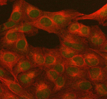 Immunofluorescent staining of PARP1 using anti-PARP1 antibody (green) and anti-Beta Tubulin antibody (red). PARP1 was detected in immunocytochemical section of U2OS cell. Enzyme antigen retrieval was performed using IHC enzyme antigen retrieval reagent for 15 mins. The cells were blocked with 10% goat serum. And then incubated with 5 ug/ml rabbit anti-PARP1 antibody and mouse anti-Beta Tubulin antibody overnight at 4oC. DyLight 488 Conjugated Goat Anti-Rabbit IgG and Cy3 Conjugated Goat Anti-Mouse IgG were used as secondary antibody at 1:500 dilution and incubated for 30 minutes at 37oC. Visualize using a fluorescence microscope and filter sets appropriate for the label used.