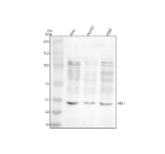Western blot analysis of REST using anti-REST antibody. Electrophoresis was performed on a 8% SDS-PAGE gel at 80V (Stacking gel) / 120V (Resolving gel) for 2 hours. Lane 1: human Hela whole cell lysates, Lane 2: human HepG2 whole cell lysates, Lane 3: human K562 whole cell lysates. After electrophoresis, proteins were transferred to a nitrocellulose membrane at 150 mA for 50-90 minutes. Blocked the membrane with 5% non-fat milk/TBS for 1.5 hour at RT. The membrane was incubated with rabbit anti-REST antibody at 0.5 ug/ml overnight at 4oC, then washed with TBS-0.1%Tween 3 times with 5 minutes each and probed with a goat anti-rabbit IgG-HRP secondary antibody at a dilution of 1:5000 for 1.5 hour at RT. The signal was developed using an ECL Plus Western Blotting Substrate. Western blot of REST using an antibody recognizing a shared region detects a prominent ~51 kDa band corresponding to the REST4 splice isoform and weaker higher bands (including ~110-125 kDa) consistent with full-length REST and proteolytic fragments; this isoform pattern is commonly observed across these cell lines.