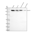 Western blot analysis of IQGAP2 using anti-IQGAP2 antibody. Lane 1: human HepG2 whole cell lysates, Lane 2: human Caco-2 whole cell lysates, Lane 3: mouse stomach tissue lysates, Lane 4: mouse brain tissue lysates. After electrophoresis, proteins were transferred to a nitrocellulose membrane at 150 mA for 50-90 minutes. Blocked the membrane with 5% non-fat milk/TBS for 1.5 hour at RT. The membrane was incubated with rabbit anti-IQGAP2 antibody at 1:500 overnight at 4oC, then washed with TBS-0.1%Tween 3 times with 5 minutes each and probed with a goat anti-rabbit IgG-HRP secondary antibody at a dilution of 1:500 for 1.5 hour at RT. The signal was developed using enhanced chemiluminescent. A specific band was detected for IQGAP2 at approximately 181 kDa. The expected molecular weight of IQGAP2 is ~181 kDa.