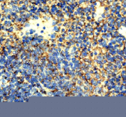 Immunohistochemical staining of ICAM1 using anti-ICAM1 antibody. ICAM1 was detected in a paraffin-embedded section of mouse spleen tissue. Heat mediated antigen retrieval was performed in EDTA buffer (pH 8.0, epitope retrieval solution). The tissue section was blocked with 10% goat serum. The tissue section was then incubated with 1:50 rabbit anti-ICAM1 antibody overnight at 4oC. Peroxidase Conjugated Goat Anti-rabbit IgG was used as secondary antibody and incubated for 30 minutes at 37oC. The tissue section was developed using an HRP secondary and DAB substrate.