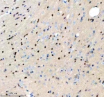 Immunohistochemical staining of PIP5K1A using anti-PIP5K1A antibody. PIP5K1A was detected in a paraffin-embedded section of rat brain tissue. Heat mediated antigen retrieval was performed in EDTA buffer (pH 8.0, epitope retrieval solution). The tissue section was blocked with 10% goat serum. The tissue section was then incubated with 2 ug/ml rabbit anti-PIP5K1A antibody overnight at 4oC. Peroxidase Conjugated Goat Anti-rabbit IgG was used as secondary antibody and incubated for 30 minutes at 37oC. The tissue section was developed using an HRP secondary and DAB substrate.