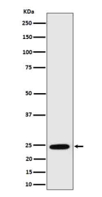 Western blot analysis of RalA in human MCF7 cell lysate using RALA antibody. Predicted molecular weight ~24 kDa.