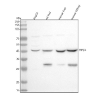 Western blot analysis of PIPOX using anti-PIPOX antibody. Lane 1: human HepG2 whole cell lysates, Lane 2: rat liver tissue lysates, Lane 3: mouse liver tissue lysates, Lane 4: mouse kidney tissue lysates. After electrophoresis, proteins were transferred to a nitrocellulose membrane at 150 mA for 50-90 minutes. Blocked the membrane with 5% non-fat milk/TBS for 1.5 hour at RT. The membrane was incubated with rabbit anti-PIPOX antibody at 0.5 ug/ml overnight at 4oC, then washed with TBS-0.1%Tween 3 times with 5 minutes each and probed with a goat anti-rabbit IgG-HRP secondary antibody at a dilution of 1:5000 for 1.5 hour at RT. The signal was developed using enhanced chemiluminescent. A major band is detected at ~40 kDa, slightly below the predicted 44 kDa, consistent with the mature peroxisomal form following N-terminal signal-peptide cleavage. In mouse and rat liver and kidney, an additional ~30 kDa band is present, likely corresponding to a tissue-specific truncated or proteolytically processed form of PIPOX described in rodent peroxisomal enzyme studies.