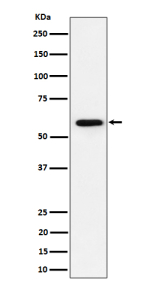 Western blot analysis of PRPF31 expression in human Jurkat cell lysate using the PRPF31 antibody. Predicted molecular weight ~55 kDa.