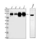 Western blot analysis of SSH3 using anti-SSH3 antibody. Lane 1: human Hela whole cell lysates, Lane 2: human 293Twhole cell lysates, Lane 3: human RT4 whole cell lysates, Lane 4: human MCF-7 whole cell lysates, Lane 5: rat stomach tissue lysates. After electrophoresis, proteins were transferred to a nitrocellulose membrane at 150 mA for 50-90 minutes. Blocked the membrane with 5% non-fat milk/TBS for 1.5 hour at RT. The membrane was incubated with rabbit anti-SSH3 antibody at 0.25 ug/ml overnight at 4oC, then washed with TBS-0.1%Tween 3 times with 5 minutes each and probed with a goat anti-rabbit IgG-HRP secondary antibody at a dilution of 1:5000 for 1.5 hour at RT. The signal was developed using enhanced chemiluminescent. Although SSH3 has a predicted molecular weight of ~73 kDa, it consistently migrates at ~90-100 kDa on SDS-PAGE, as reported in the literature. The higher apparent size reflects extensive phosphorylation and the acidic, SDS-resistant composition of SSH3. In rat stomach lysate, a slightly faster-migrating ~80 kDa band is observed, likely corresponding to a less modified or truncated form of the protein.