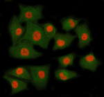 Immunofluorescent staining of RING1 using anti-RING1 antibody (red) and anti-Beta Tubulin antibody (green). RING1 was detected in immunocytochemical section of cell. Enzyme antigen retrieval was performed using IHC enzyme antigen retrieval reagent for 15 mins. The cells were blocked with 10% goat serum. And then incubated with 5 ug/ml rabbit anti-RING1 antibody and mouse anti-Beta Tubulin antibody overnight at 4oC. Cy3 Conjugated Goat Anti-Rabbit IgG and FITC Conjugated Goat Anti-Mouse IgG were used as secondary antibody at 1:500 dilution and incubated for 30 minutes at 37oC. Visualize using a fluorescence microscope and filter sets appropriate for the label used.