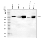 Western blot analysis of TBR1 using anti-TBR1 antibody. Lane 1: human SH-SY5Y whole cell lysates, Lane 2: rat brain tissue lysates, Lane 3: rat C6 whole cell lysates, Lane 4: mouse brain tissue lysates, Lane 5: mouse Neuro-2a whole cell lysates. After electrophoresis, proteins were transferred to a nitrocellulose membrane at 150 mA for 50-90 minutes. Blocked the membrane with 5% non-fat milk/TBS for 1.5 hour at RT. The membrane was incubated with rabbit anti-TBR1 antibody at 0.5 ug/ml overnight at 4oC, then washed with TBS-0.1%Tween 3 times with 5 minutes each and probed with a goat anti-rabbit IgG-HRP secondary antibody at a dilution of 1:5000 for 1.5 hour at RT. The signal was developed using enhanced chemiluminescent. TBR1 antibody detects a doublet at ~70-75 kDa across the indicated brain-derived samples and cell lines. TBR1's calculated mass is ~74 kDa; the closely spaced pair is consistent with differential post-translational modification (commonly phosphorylation) and is frequently observed for this nuclear transcription factor.
