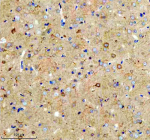 Immunohistochemical staining of PICK1 using anti-PICK1 antibody. PICK1 was detected in a paraffin-embedded section of rat brain tissue. Heat mediated antigen retrieval was performed in EDTA buffer (pH 8.0, epitope retrieval solution). The tissue section was blocked with 10% goat serum. The tissue section was then incubated with 2 ug/ml rabbit anti-PICK1 antibody overnight at 4oC. Peroxidase Conjugated Goat Anti-rabbit IgG was used as secondary antibody and incubated for 30 minutes at 37oC. The tissue section was developed using an HRP secondary and DAB substrate.
