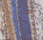 Immunohistochemical staining of GRK1 using anti-GRK1 antibody. GRK1 was detected in a paraffin-embedded section of rat eye tissue. Heat mediated antigen retrieval was performed in EDTA buffer (pH 8.0, epitope retrieval solution). The tissue section was blocked with 10% goat serum. The tissue section was then incubated with 2 ug/ml rabbit anti-GRK1 antibody overnight at 4oC. Peroxidase Conjugated Goat Anti-rabbit IgG was used as secondary antibody and incubated for 30 minutes at 37oC. The tissue section was developed using an HRP secondary and DAB substrate.