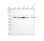 Western blot analysis of HRD1/SYVN1 using anti-SYVN1 antibody. Electrophoresis was performed on a 10% SDS-PAGE gel at 80V (Stacking gel) / 120V (Resolving gel) for 2 hours. Lane 1: human Hela whole cell lysates, Lane 2: human Jurkat whole cell lysates, Lane 3: human HepG2 whole cell lysates, Lane 4: human MCF-7 whole cell lysates, Lane 5: mouse lung tissue lysates. After electrophoresis, proteins were transferred to a nitrocellulose membrane at 150 mA for 50-90 minutes. Blocked the membrane with 5% non-fat milk/TBS for 1.5 hour at RT. The membrane was incubated with rabbit anti-SYVN1 antibody at 1: 500 overnight at 4oC, then washed with TBS-0.1%Tween 3 times with 5 minutes each and probed with a goat anti-rabbit IgG-HRP secondary antibody at a dilution of 1:5000 for 1.5 hour at RT. The signal was developed using an ECL Plus Western Blotting Substrate. The expected molecular weight of HRD1/SYVN1 is at 68 kDa.