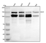 Western blot analysis of SSH1 using anti-SSH1 antibody. Lane 1: human Hela whole cell lysates, Lane 2: human 293T whole cell lysates, Lane 3: human Jurkat whole cell lysates, Lane 4: human Raji whole cell lysates. After electrophoresis, proteins were transferred to a nitrocellulose membrane at 150 mA for 50-90 minutes. Blocked the membrane with 5% non-fat milk/TBS for 1.5 hour at RT. The membrane was incubated with rabbit anti-SSH1 antibody at 0.5 ug/ml overnight at 4oC, then washed with TBS-0.1%Tween 3 times with 5 minutes each and probed with a goat anti-rabbit IgG-HRP secondary antibody at a dilution of 1:5000 for 1.5 hour at RT. The signal was developed using enhanced chemiluminescent. SSH1 antibody detects a doublet at ~110-120 kDa with an additional slower band at ~150 kDa across the indicated lysates. Although the predicted mass is ~116 kDa, Slingshot-1 typically shows phosphorylation-dependent mobility shifts, with hyperphosphorylated/14-3-3-bound forms migrating more slowly.