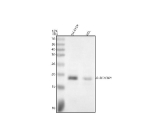 Western blot analysis of P-EIF4EBP1 using anti-Phospho-eIF4EBP1 (Thr70) antibody. Electrophoresis was performed on a 12% SDS-PAGE gel at 80V (Stacking gel) / 120V (Resolving gel) for 2 hours. Lane 1: human SH-SY5Y whole cell lysates, Lane 2: human HEL whole cell lysates. After electrophoresis, proteins were transferred to a nitrocellulose membrane at 150 mA for 50-90 minutes. Blocked the membrane with 5% non-fat milk/TBS for 1.5 hour at RT. The membrane was incubated with rabbit anti-Phospho-eIF4EBP1 (Thr70) antibody at 1:500 overnight at 4oC, then washed with TBS-0.1%Tween 3 times with 5 minutes each and probed with a goat anti-rabbit IgG-HRP secondary antibody at a dilution of 1:5000 for 1.5 hour at RT. The signal was developed using an ECL Plus Western Blotting Substrate. A specific band was detected for P-EIF4EBP1 at approximately 17 kDa. The expected molecular weight of P-EIF4EBP1 is ~17 kDa.