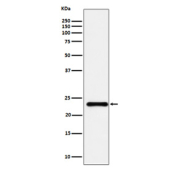 Western blot analysis of HSPC150 expression in human HeLa cell lysate using UBE2T antibody. Predicted molecular weight ~22 kDa.
