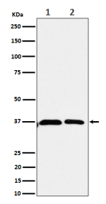 Western blot analysis of Serine racemase expression in human (1) 293 cell lysate; (2) U-87 MG cell lysate using SRR antibody. Predicted molecular weight ~37 kDa.