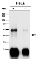 Immunoprecipitation analysis using the Clu antibody at 1:50 dilution. Western blot at 1:500 dilution. Clusterin IP from HeLa lysate. Under reducing conditions, a faint clusterin band appears in the low-40 kDa range (alpha chain). Prominent ~50-55 kDa and ~25 kDa bands represent IgG heavy and light chains from the IP antibody.