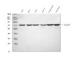 Western blot analysis of TAGAP using anti-TAGAP antibody. Lane 1: human Jurkat whole cell lysates, Lane 2: human Daudi whole cell lysates, Lane 3: human HL-60 whole cell lysates, Lane 4: rat PC-12 whole cell lysates, Lane 5: mouse thymus tissue lysates, Lane 6: mouse SP2/0 whole cell lysates. After electrophoresis, proteins were transferred to a nitrocellulose membrane at 150 mA for 50-90 minutes. Blocked the membrane with 5% non-fat milk/TBS for 1.5 hour at RT. The membrane was incubated with rabbit anti-TAGAP antibody at 1:500 overnight at 4oC, then washed with TBS-0.1%Tween 3 times with 5 minutes each and probed with a goat anti-rabbit IgG-HRP secondary antibody at a dilution of 1:1000 for 1.5 hour at RT. The signal was developed using enhanced chemiluminescent. Western blot detection of TAGAP shows a single band at ~70 kDa across tested lysates. Despite a calculated mass of ~81 kDa, TAGAP frequently migrates lower on SDS-PAGE, consistent with isoform- and composition-dependent mobility.