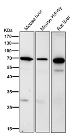 Western blot testing of mouse samples using the RPN1 antibody at 1:3000 dilution for 1 hour at room temperature. A predominant band is detected at an approximately 68 kDa in all samples, consistent with the mature N-glycosylated ER membrane protein ribophorin I described in the literature. Additional weaker bands between roughly 50 and 60 kDa, particularly in rodent liver, likely represent truncated or processed RPN1 species generated during normal ER associated degradation rather than distinct full length isoforms.