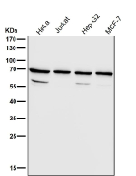 Western blot testing of human samples using the RPN1 antibody at 1:3000 dilution for 1 hour at room temperature. A predominant band is detected at an approximately 68 kDa in all samples, consistent with the mature N-glycosylated ER membrane protein ribophorin I described in the literature. Additional weaker bands between roughly 50 and 60 kDa, likely represent truncated or processed RPN1 species generated during normal ER associated degradation rather than distinct full length isoforms.