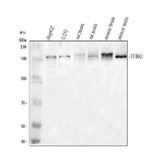 Western blot analysis of TTBK1 using anti-TTBK1 antibody. Electrophoresis was performed on a 8% SDS-PAGE gel at 80V (Stacking gel) / 120V (Resolving gel) for 2 hours. Lane 1: human HepG2 whole cell lysates, Lane 2: human U251 whole cell lysates, Lane 3: rat brain tissue lysates, Lane 4: rat testis tissue lysates, Lane 5: mouse brain tissue lysates, Lane 6: mouse testis tissue lysates. After electrophoresis, proteins were transferred to a nitrocellulose membrane at 150 mA for 50-90 minutes. Blocked the membrane with 5% non-fat milk/TBS for 1.5 hour at RT. The membrane was incubated with rabbit anti-TTBK1 antibody at 0.5 ug/ml overnight at 4oC, then washed with TBS-0.1%Tween 3 times with 5 minutes each and probed with a goat anti-rabbit IgG-HRP secondary antibody at a dilution of 1:5000 for 1.5 hour at RT. The signal was developed using an ECL Plus Western Blotting Substrate. A predominant band is detected just above an approximately 150 kDa in all samples, running higher than the predicted ~143 kDa size but consistent with the reported 150 kDa apparent molecular weight of full length, heavily phosphorylated TTBK1 in the literature.