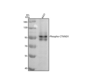 Western blot testing of human A431 cell lysate with Phospho-p120 Catenin (Tyr228) antibody. Predicted molecular weight of isoform 1: 102-108 kDa and isoform 2: 95-102 kDa.