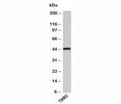 TRH Receptor antibody western blot on human samples