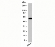 SIN1 antibody western blot testing with human samples