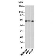 HSP60 antibody western blot with human samples