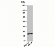 Acid Phosphatase western blot of human samples