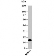 Western blot testing of human samples with Survivin antibody at 2ug/ml. Predicted molecular weight ~16 kDa.