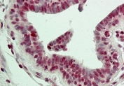 IHC testing of FFPE human breast tissue with LSD1 antibody at 5ug/ml. HIER: steam tissue sections in pH6, 10mM citrate buffer, for 10-20 min followed by cooling at RT for 20 min.