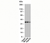 PDLIM1 Antibody western blot test of human samples