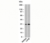 DRAM antibody western blot of human samples