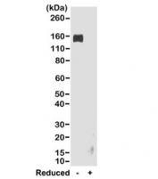 Western blot of nonreduced(-) and reduced(+) rabbit IgG (20ng/lane), using 0.2ug/ml of the recombinant Rabbit IgG Fc antibody. This antibody reacts to nonreduced rabbit IgG (~150 kDa).