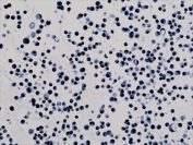 ICC testing of human HepG2 cells with recombinant H3K9ac antibody.