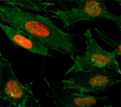 ICC/IF test of HeLa cells treated with sodium butyrate using recombinant H3K4ac antibody (red). Actin filaments have been labeled with fluorescein phalloidin (green).