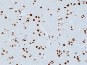 IHC staining of FFPE human brain tissue with recombinant H3K27me3 antibody. HIER: boil tissue sections in pH6, 10mM citrate buffer, for 20 min and allow to cool before testing.
