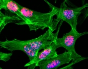 ICC/IF staining of HeLa cells treated with sodium butyrate using recombinant H3K23ac antibody (red). Actin filaments have been labeled with fluorescein phalloidin (green).