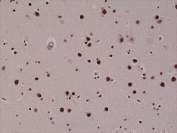 IHC testing of FFPE human brain with recombinant 5hmC antibody.