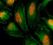 ICC/IF staining of human HeLa cells using recombinant Histone H2AX antibody (red). Actin filaments have been labeled with fluorescein phalloidin (green).