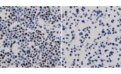 ICC staining of 293T cells expressing His-Tag nuclear protein X (left) and negative control HepG2 cells (right) using the recombinant His Tag antibody.